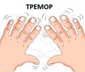 Что делать, если трясутся руки при волнении?